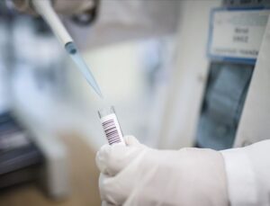 Japonya’da maymun çiçeği virüsünden birinci mevt kayıtlara geçti
