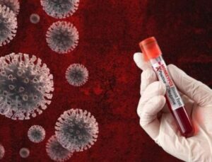 Nijerya’da M çiçeği olay sayısı artıyor