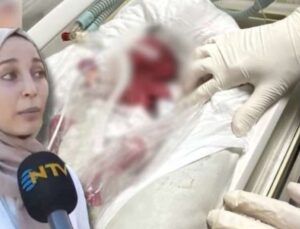 Ömer bebeğin bacağına ne oldu? Özel hastaneye yanlış uygulama suçlaması